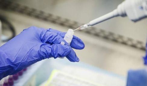 Mbi 27.7 mln raste me Covid ne mbare boten: Ja sa eshte numri i vdekjeve